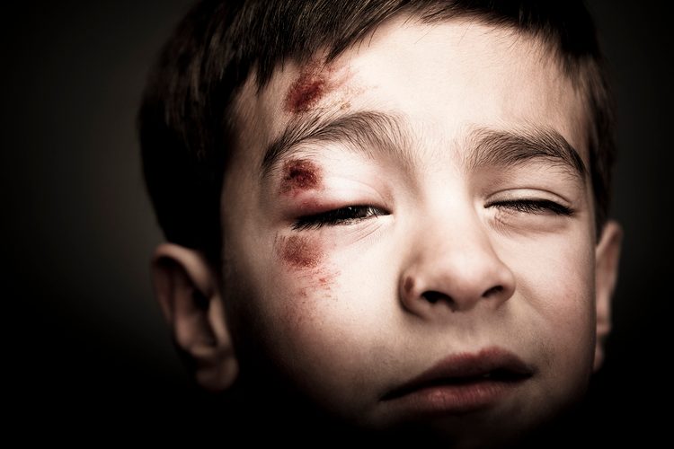 Eine Prügelei auf dem Schulhof muss nichts mit Mobbing zu tun haben – sie kann aber ein Indiz sein. Bild: Solina Images/Blend Images LLC /Gallery Stock