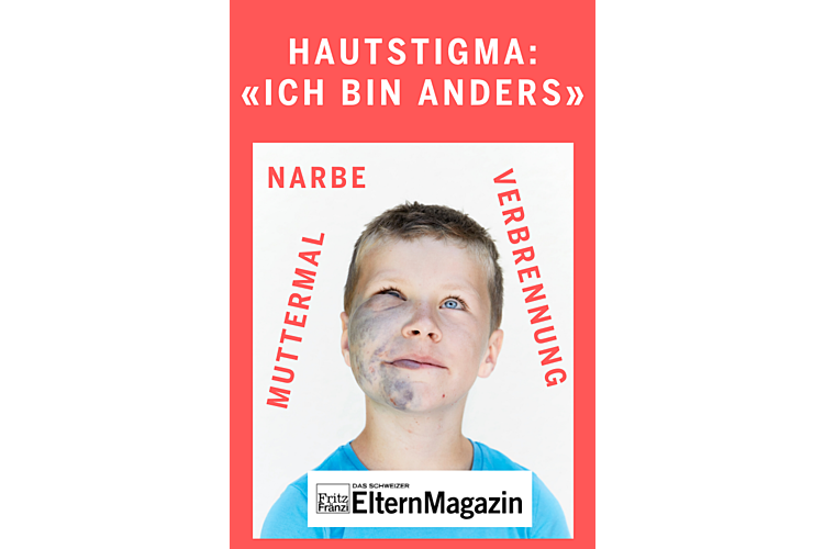 54ac1377422db0ef960cd1fb2abeb2a4.png Möchten Sie sich diesen Artikel merken? Dann pinnen Sie dieses Bild auf Ihre Pinnwand bei Pinterest!