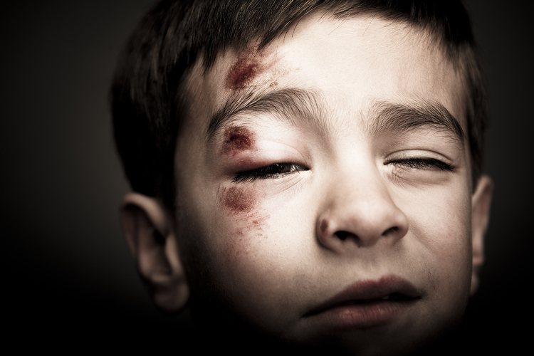 ef9e4e858031c8346da250172056715e.jpg Eine Prügelei auf dem Schulhof muss nichts mit Mobbing zu tun haben – sie kann aber ein Indiz sein. Bild: Solina Images/Blend Images LLC /Gallery Stock