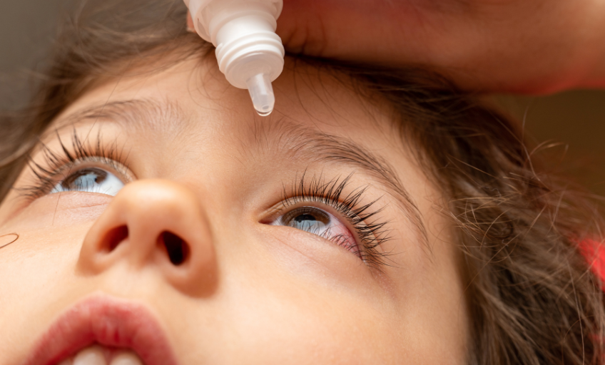 23-4-Allergien-Augentropfen-Schweizer-Elternmagazin-Ab